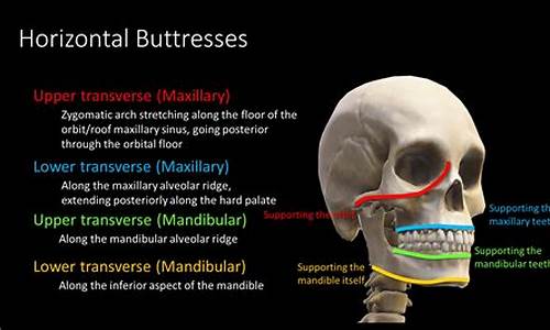 buttress_buttress图片